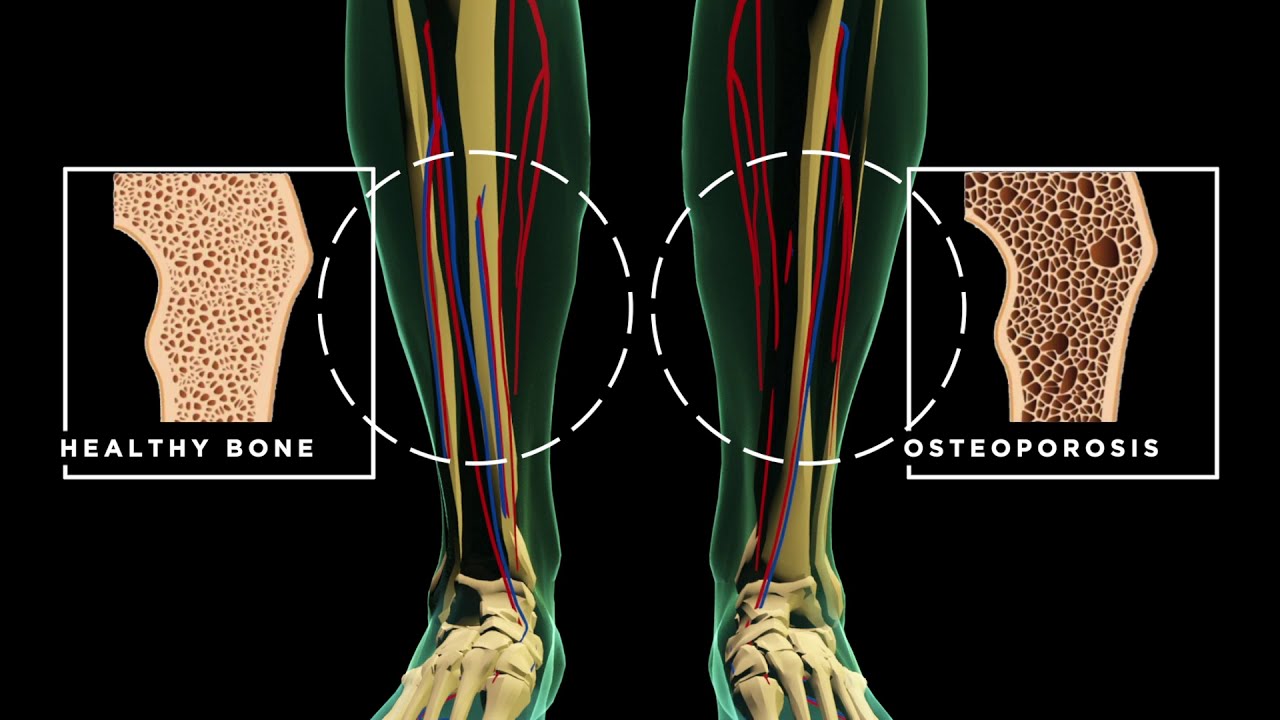A Look Inside the Body with Life Line Screening