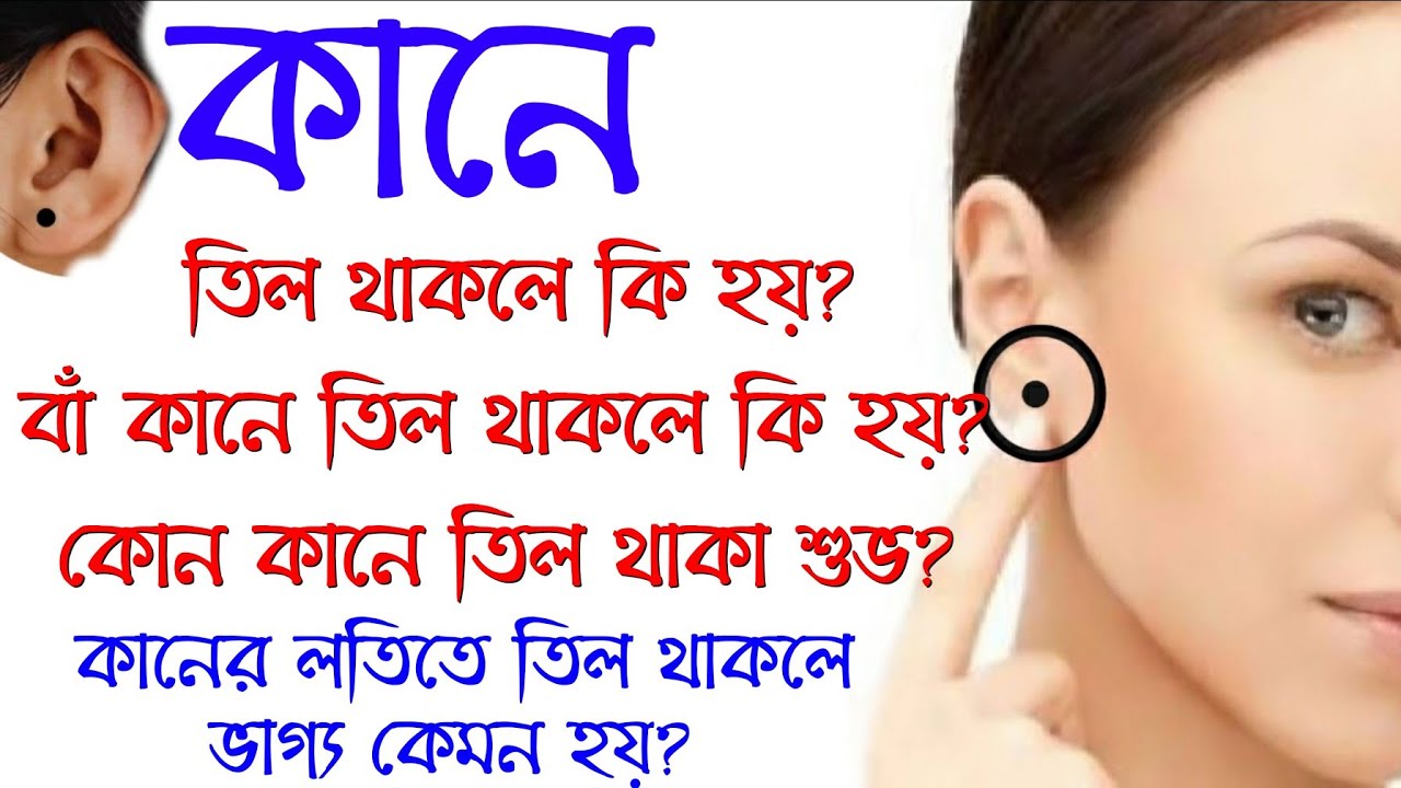 Kane til thakley ki hoy | কানে তিল থাকলে কি হয় | What does mole on the ear mean