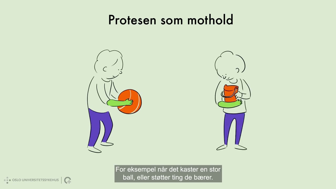 Armproteser hos barn
