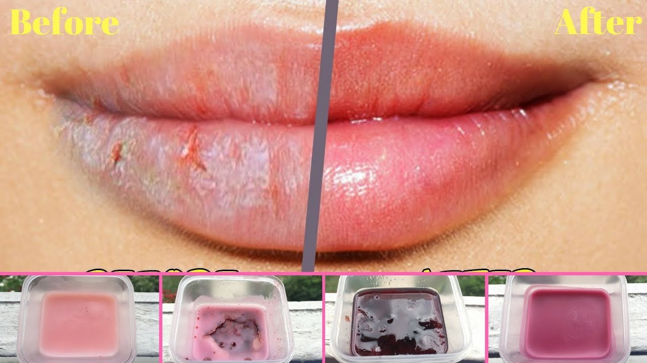 Lip Balm | Get soft & pink lips | Beetroot lip balm | Lip balm hacks | Lip scrub | AVNI