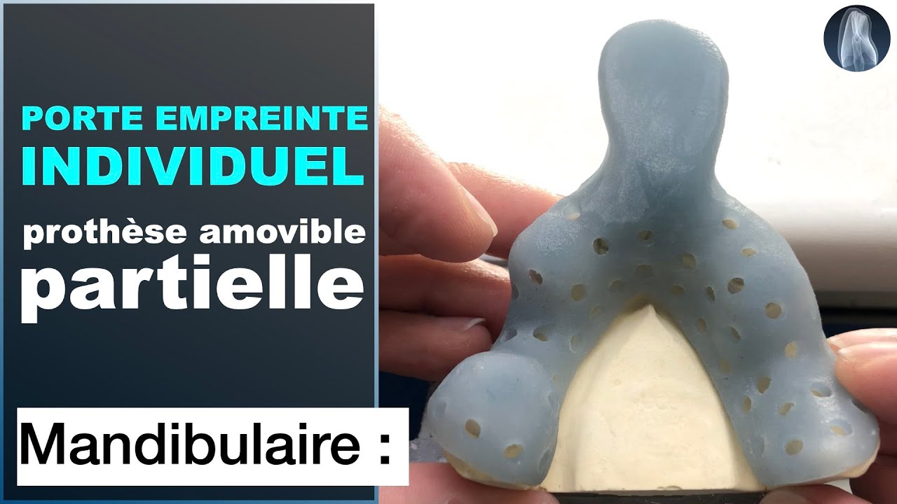 🦷 Créez un Porte-Empreinte Individuel Partiel Mandibulaire : Guide Étape par Étape 🔧✨