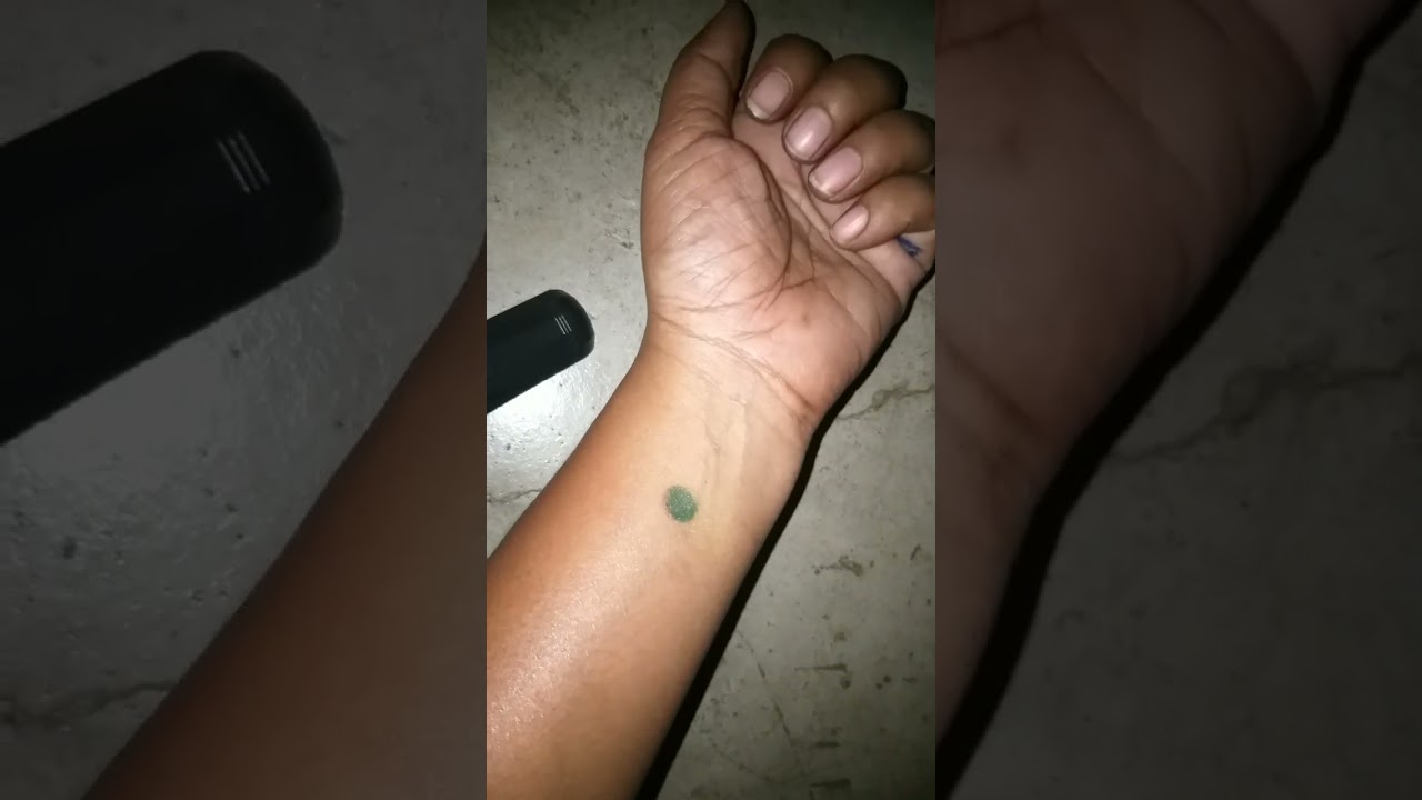 Acupressure special point. Magical point of the Body acupuncture #acupressure #reflexology