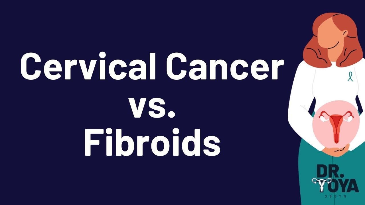 Cervical Cancer VS. Fibroids