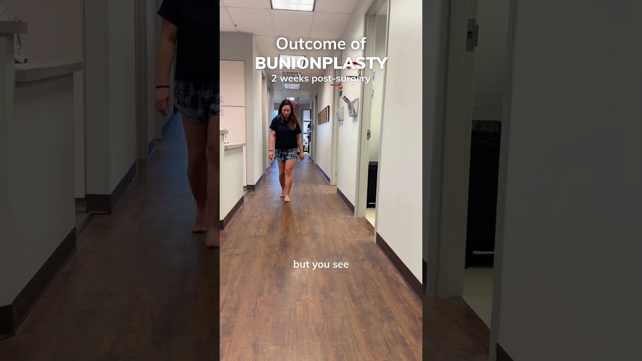 Walking Just 2 Weeks After Bunionplasty&reg; Surgery | Dr. Justin Kane - OINT