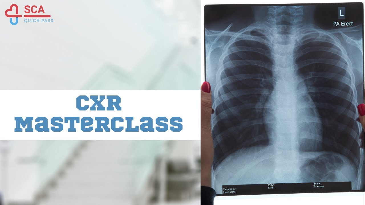 Cracking the CXR: Common Abnormalities Explained