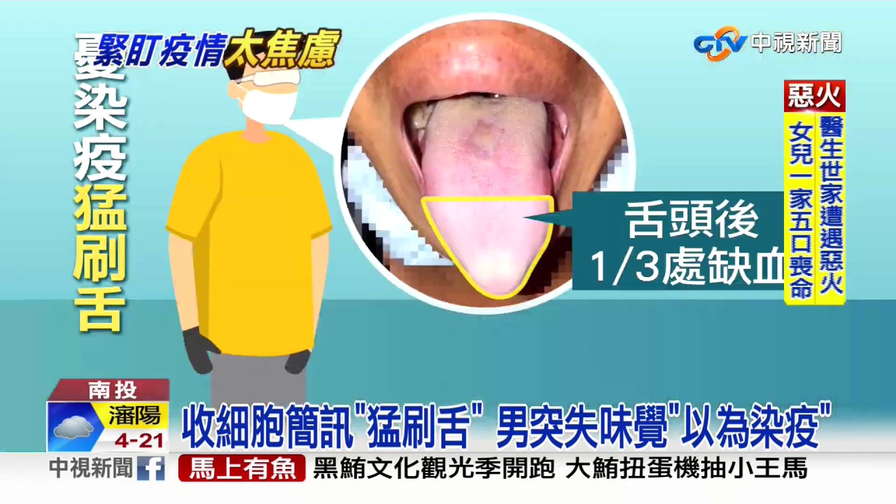 收細胞簡訊