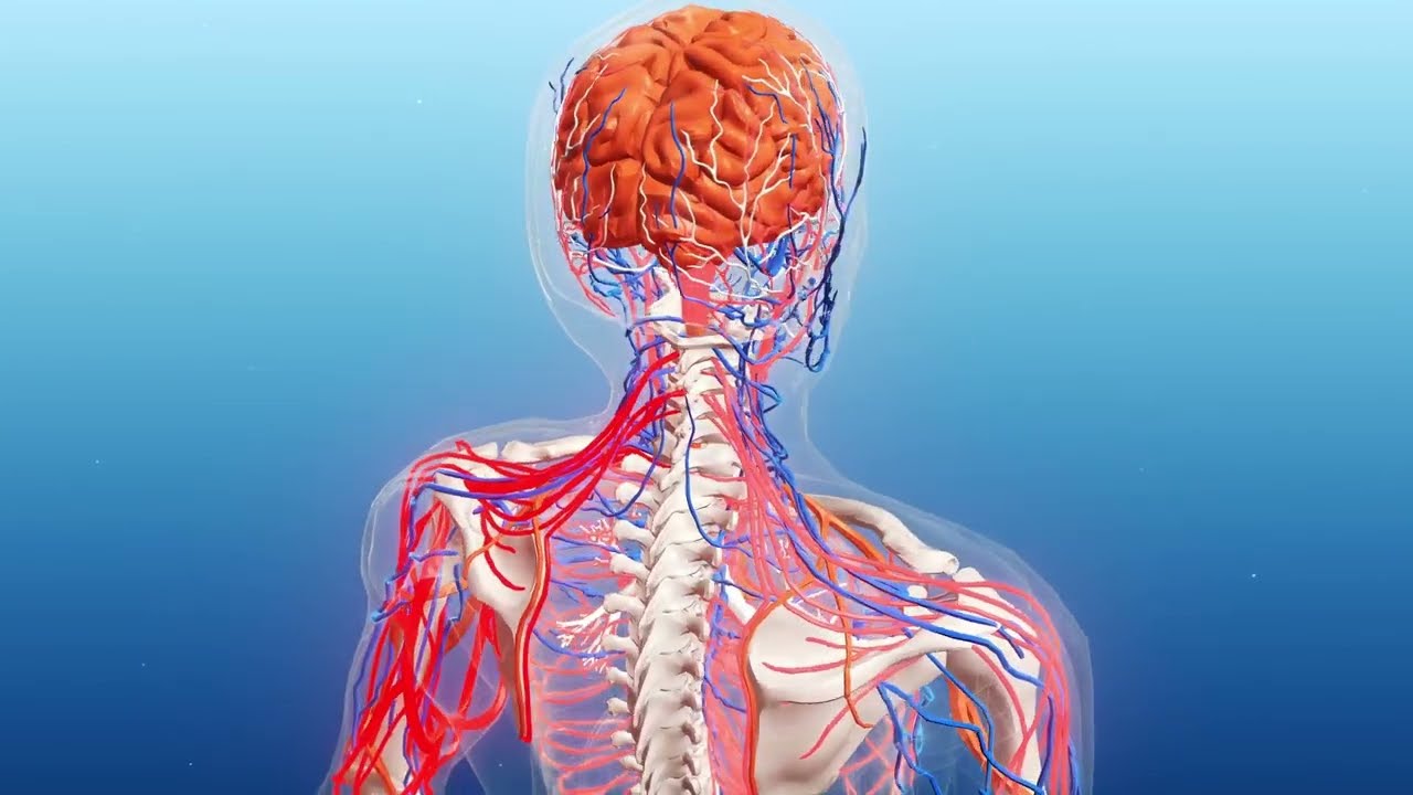 Strokes and Carotid Artery Disease