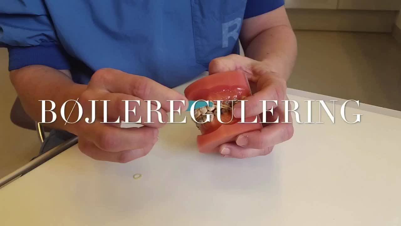 Bøjleregulering
