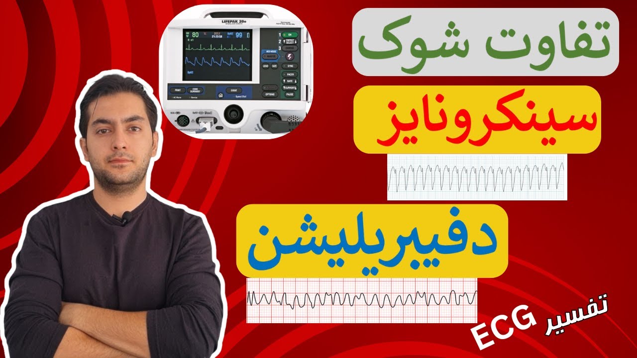 تفاوت شوک سینکرونایز و دفیبریله