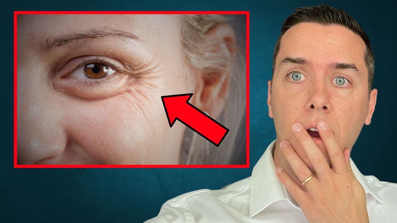 7 Simple Tricks to Eliminate Crow's Feet (Without Botox)