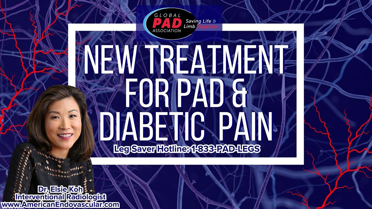 Beyond Blockages: Neurostimulators as the Next Step in PAD Pain Management
