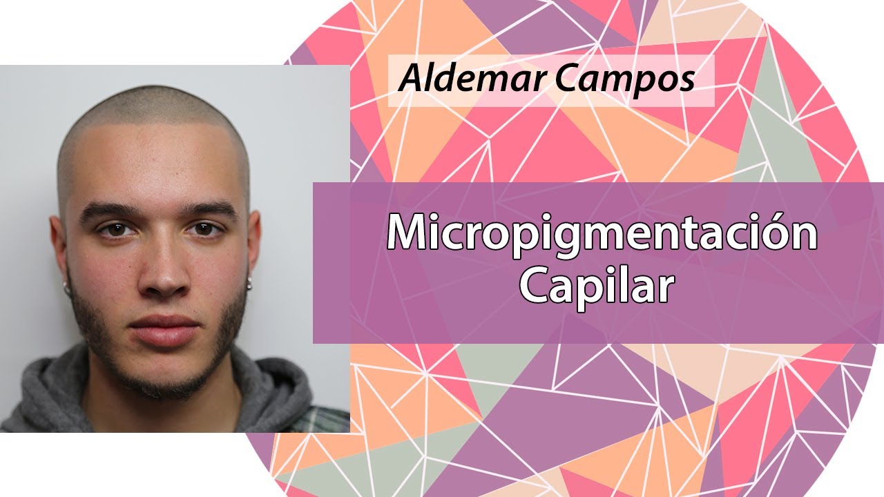 Micropigmentación Capilar 