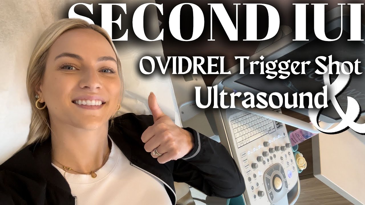 SECOND IUI CYCLE | Ovidrel Trigger Shot | TTC Journey | Unexplained Infertility