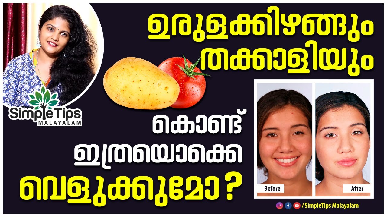 Skin Whitening | Natural Remedies | SimpleTips Malayalam | Beauty Channel