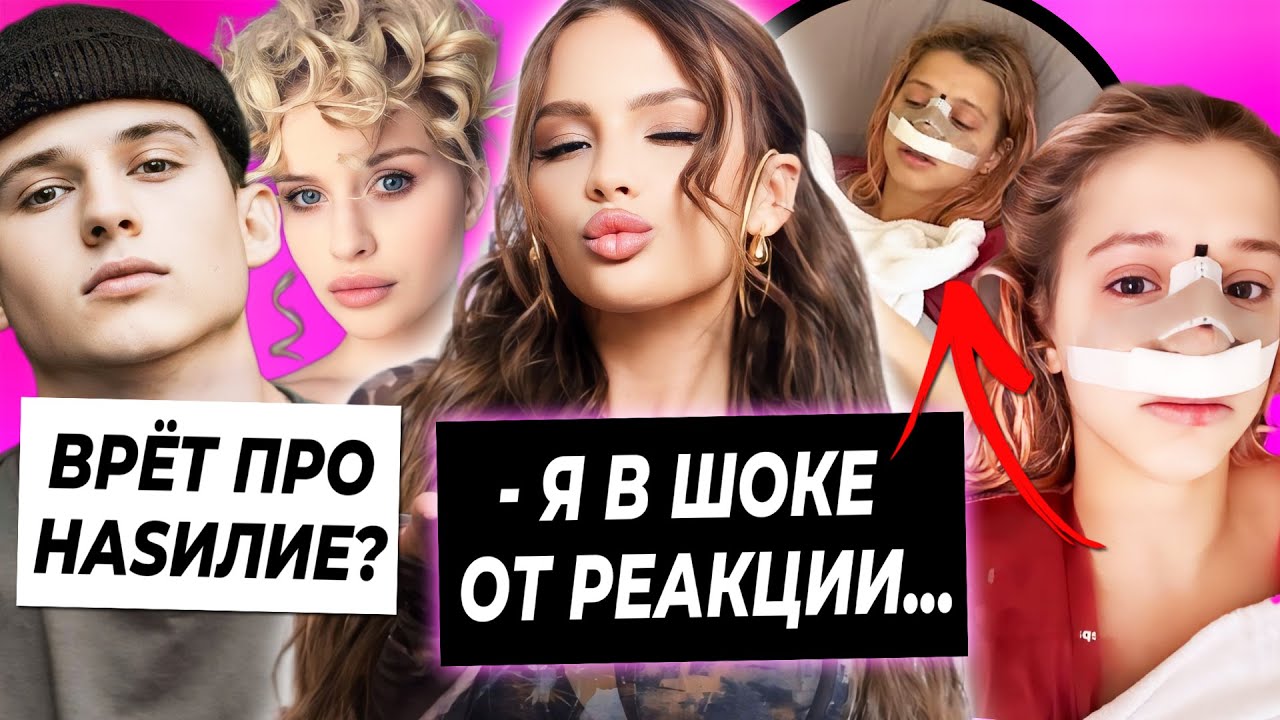 Операция Юли - что с носом? / Шок Карнавал от интервью / Абрикоса соврала про Сеню Бардаша?