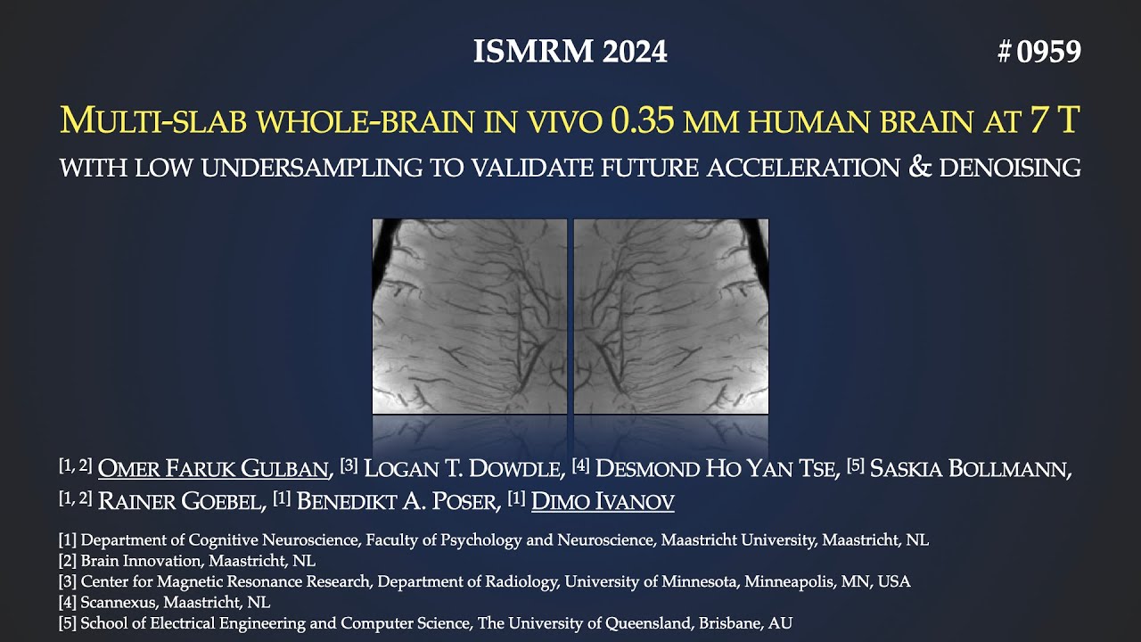 ISMRM 2024 Talk (0959) - Multi-slab whole-brain in vivo 0.35 mm human brain at 7 T