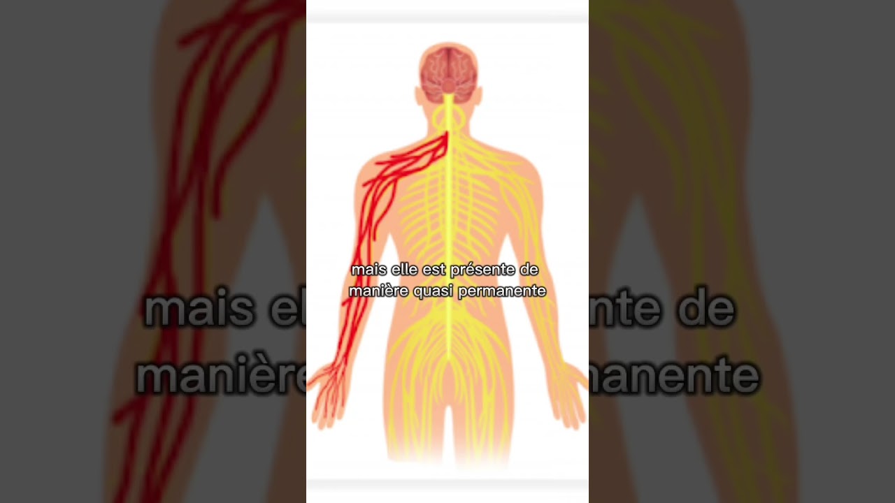La n&eacute;vralgie cervico-brachiale expliqu&eacute;e en 1 minute