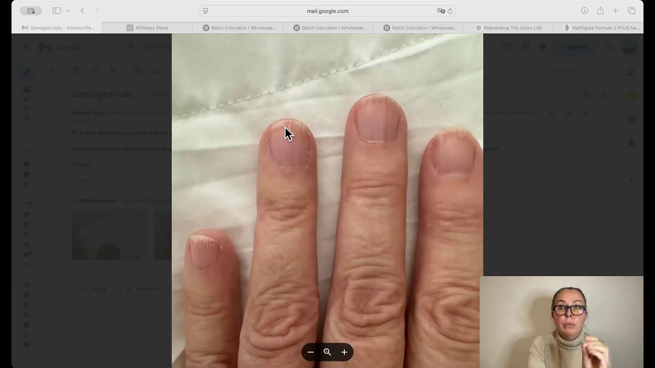 Send me photos of your nails so I can professionally assess them!