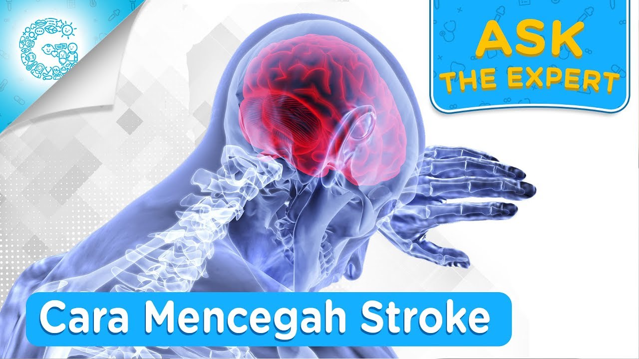 Cara Mudah Mencegah Stroke! - dr. L. Aswin, Sp.PD