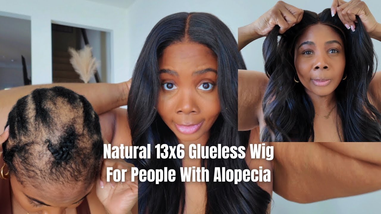 Why 13x6 Again?! HAIR LOSS–SAFE!!! MOST REALISTIC GLUELESS WIG FOR ALOPECIA | FROM HAIRVIVI