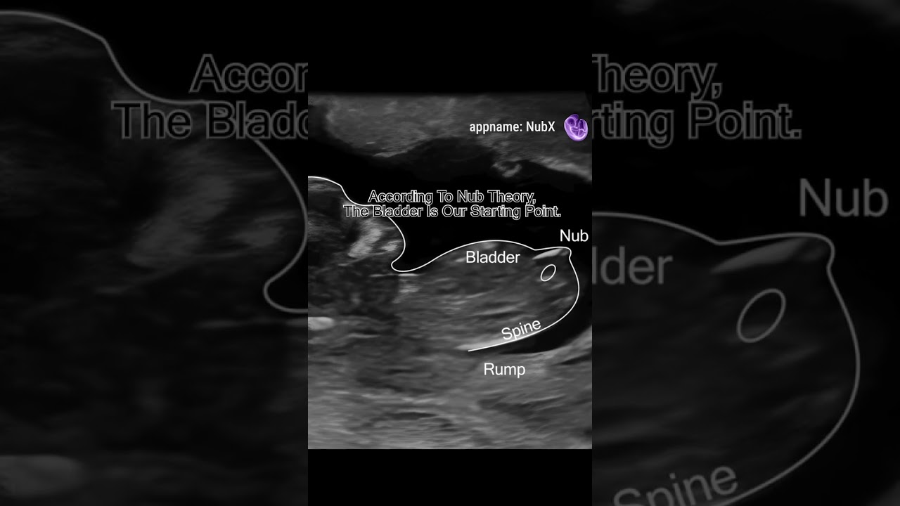 Ultrasound Gender Reveal with NubX App!
