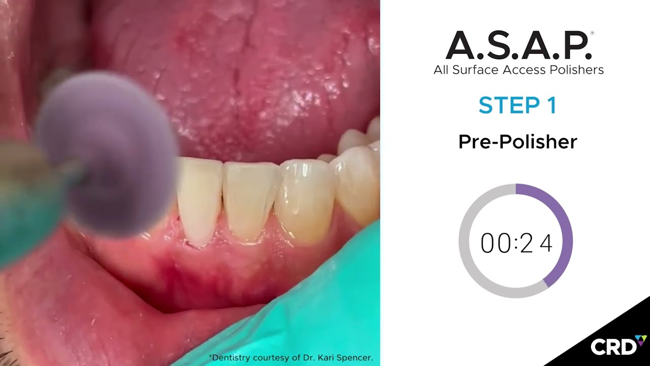 Get more shine in less time with A.S.A.P. All Surface Access Polishers!
