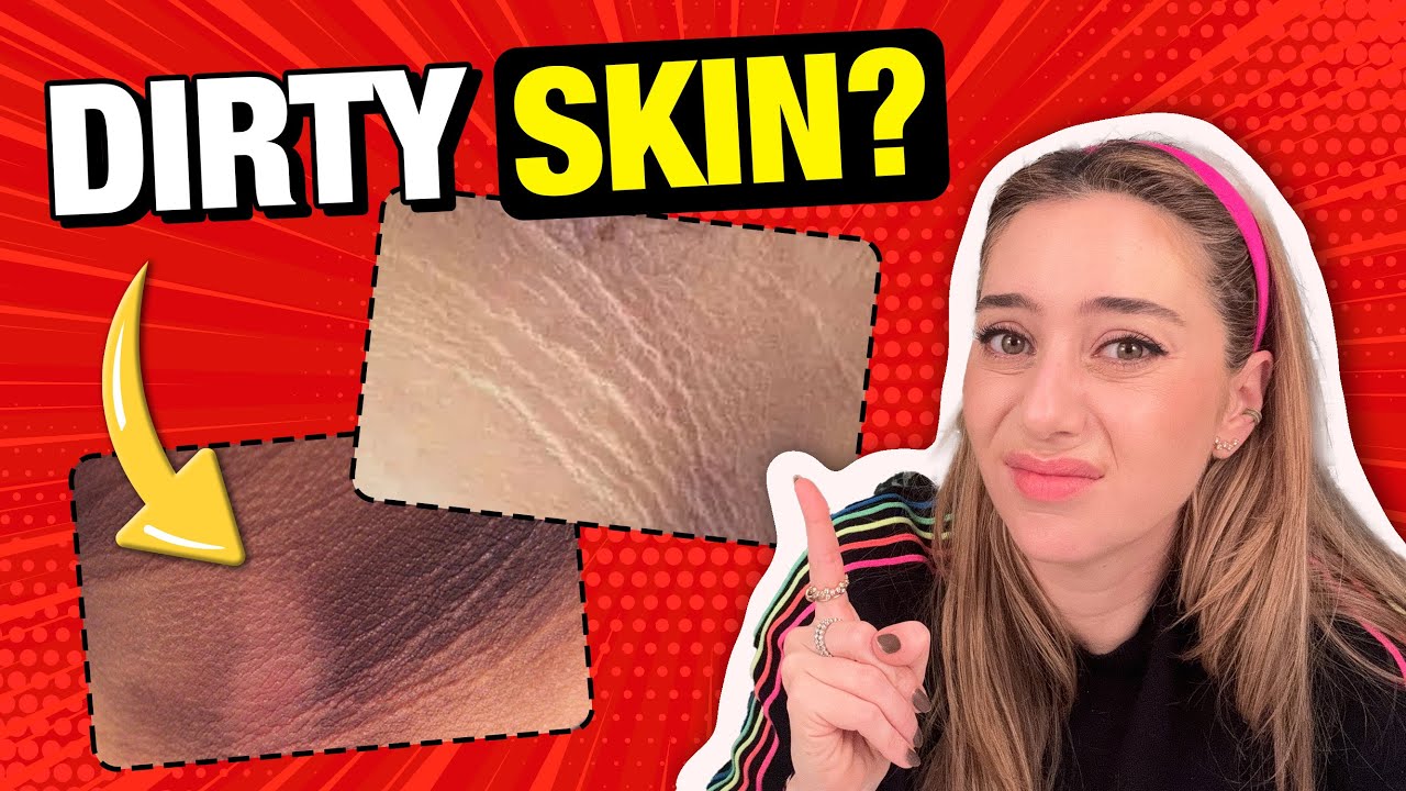 Dirty Skin? Dark Underarms? How to Prevent & Treat Acanthosis Nigracans | Dr. Shereene Idriss
