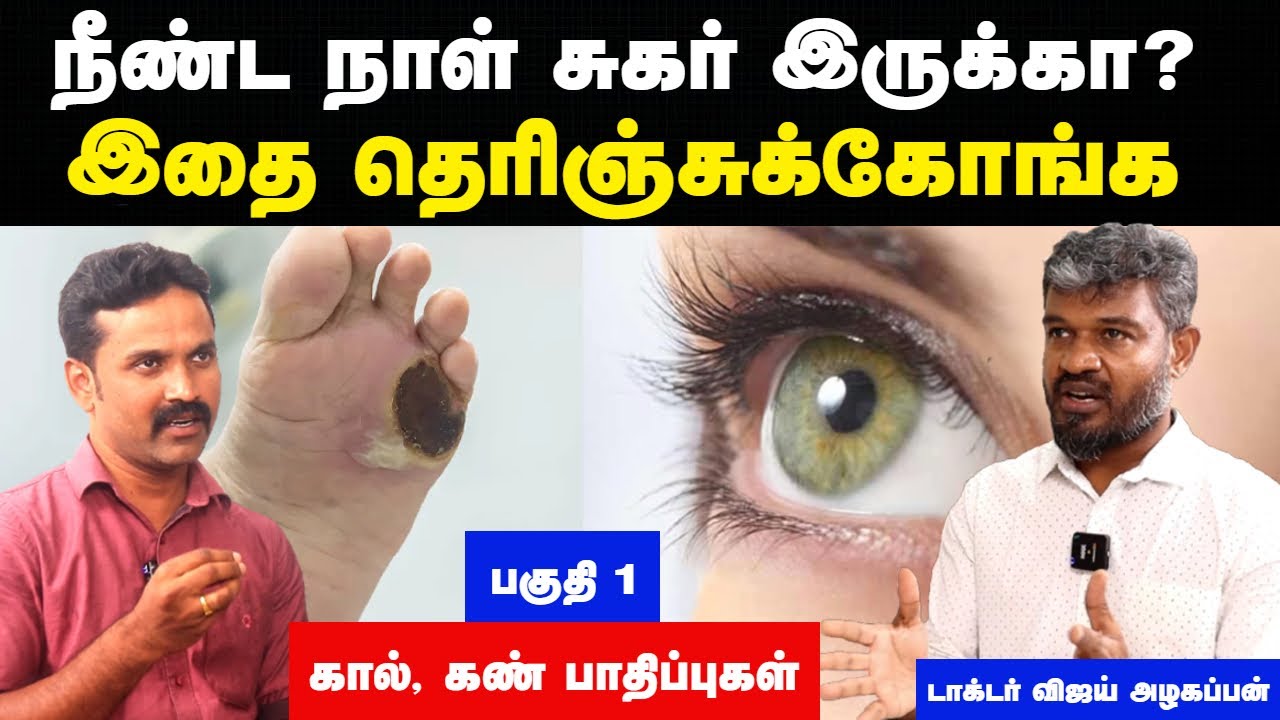 சுகர் அதிகமானால் என்ன நடக்கும்? | Sugar patient problems in tamil | Diabetes |Doctor Interview tamil