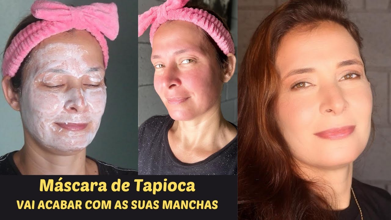 CLAREADOR COM TAPIOCA vai acabar com as suas manchas