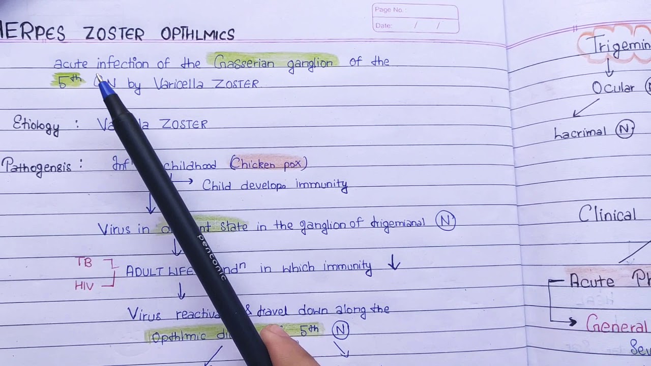 Herpes Zoster Ophthalmics viral keratitis (AK Khurana)