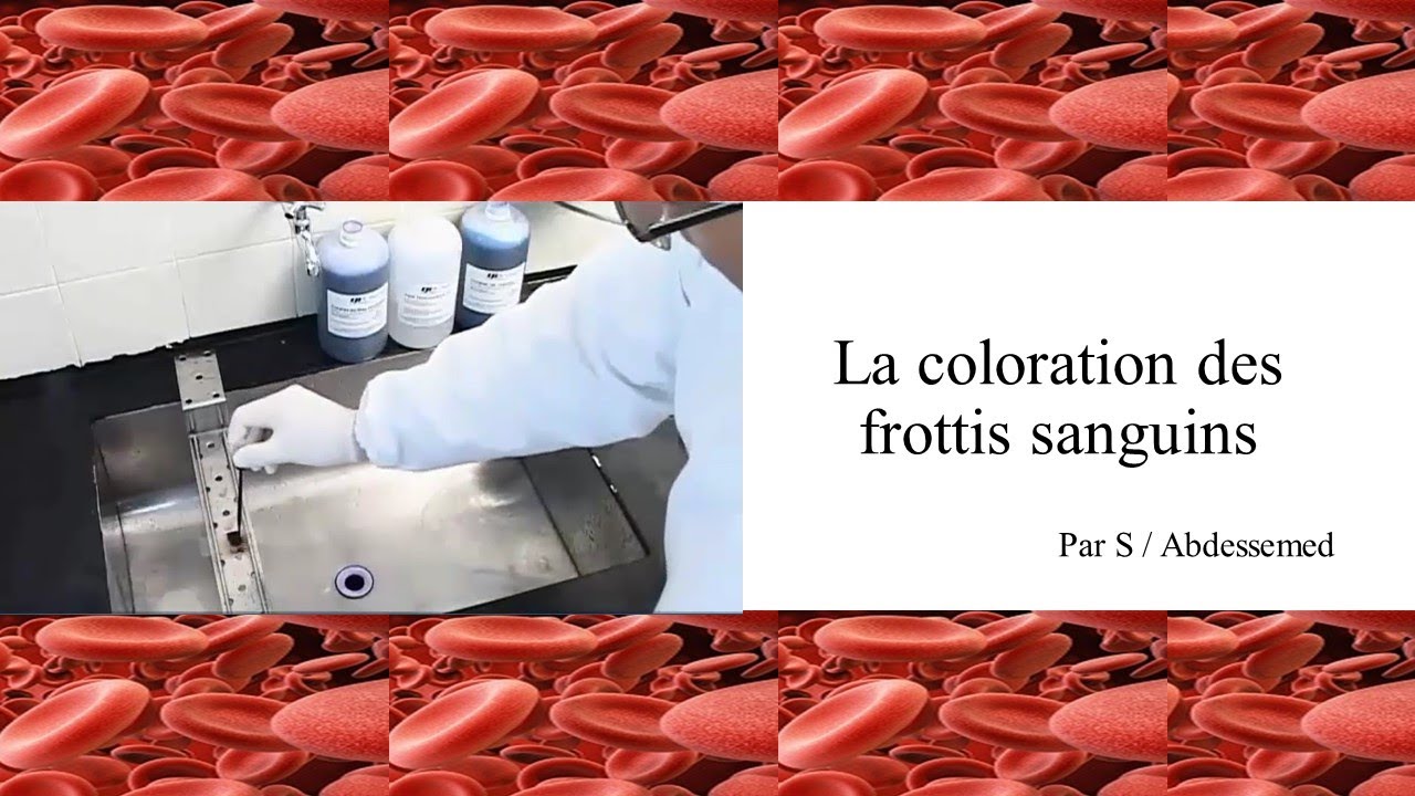 La coloration des frottis sanguins
