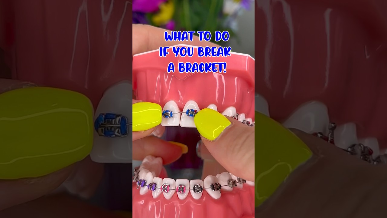 WHAT TO DO IF YOU BREAK A BRACKET / BRACES OFF TIPS 🦷 IF WAX DOESN'T WORK ORTHODONTIST REACTS