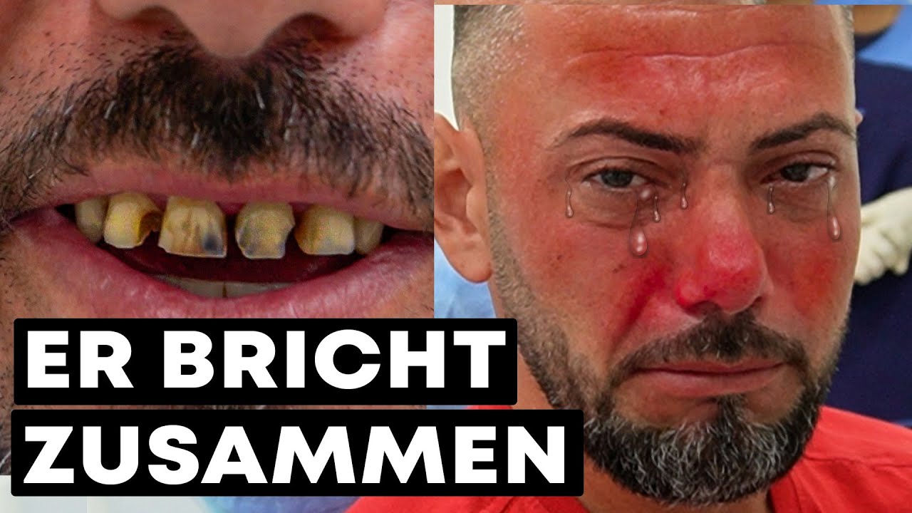 EMOTIONALE TRANSFORMATION - Seine neuen Zähne bringen ihn zum weinen