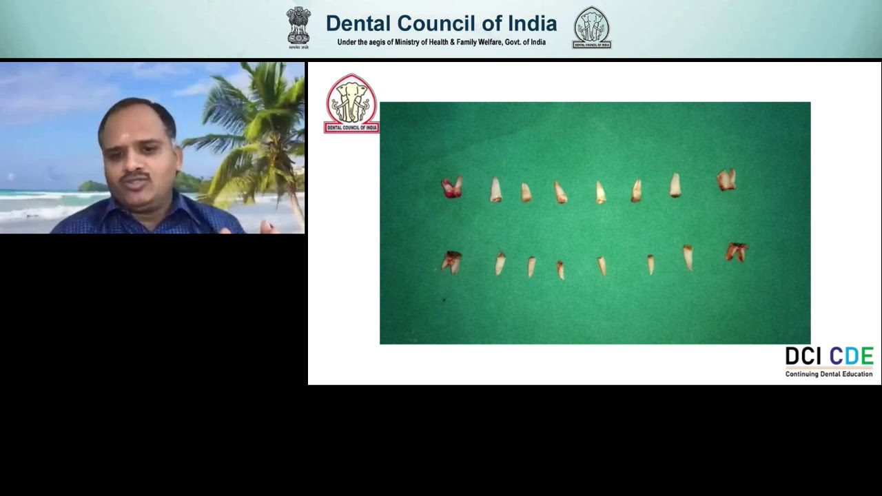 DCI Webinar 19 - Early Childhood Caries  - Question are the Answers