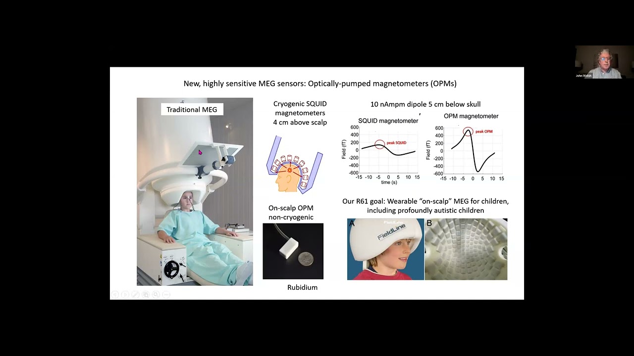 R61-03: Integrated movement tracking for pediatric OPM-MEG studies of intellectual disability
