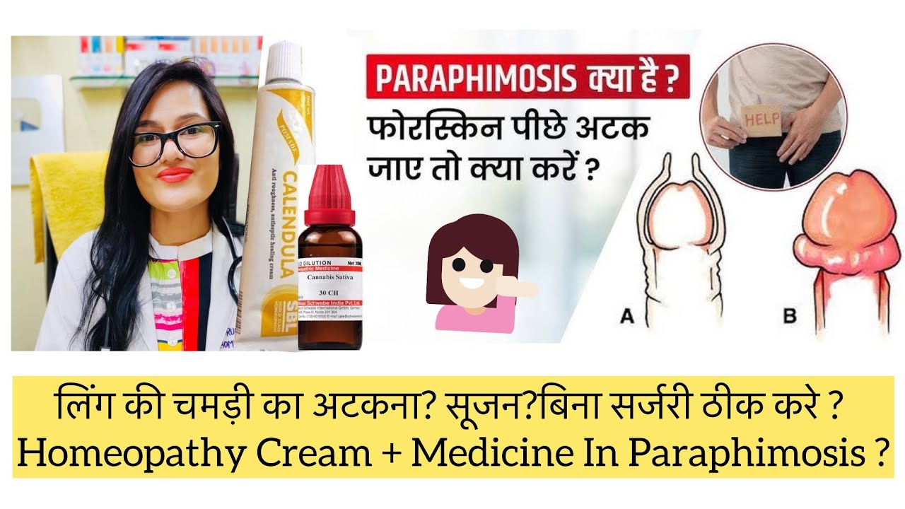 लिंग की चमड़ी का अटकना?Paraphimosis Homeopathic Medicine? Paraphimosis Treatment Without Surgery?