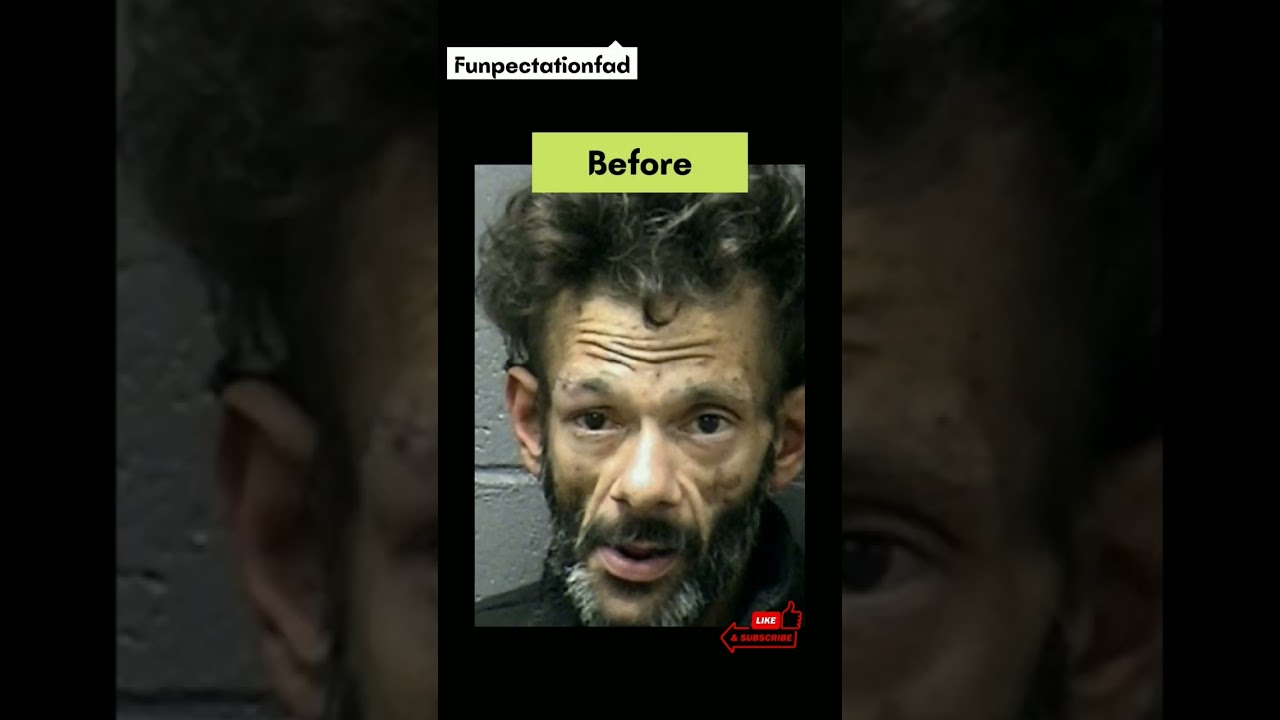 People Before And After Quitting Drugs #shorts