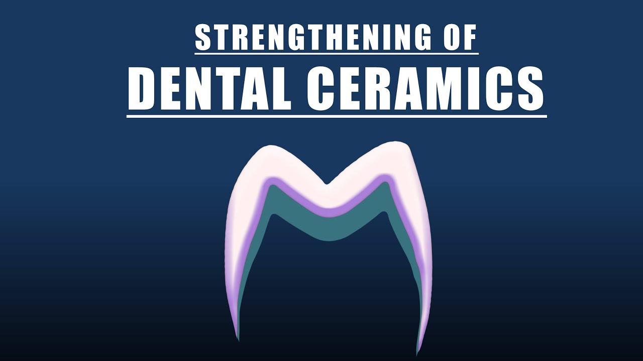 Dental ceramics | Strengthening techniques