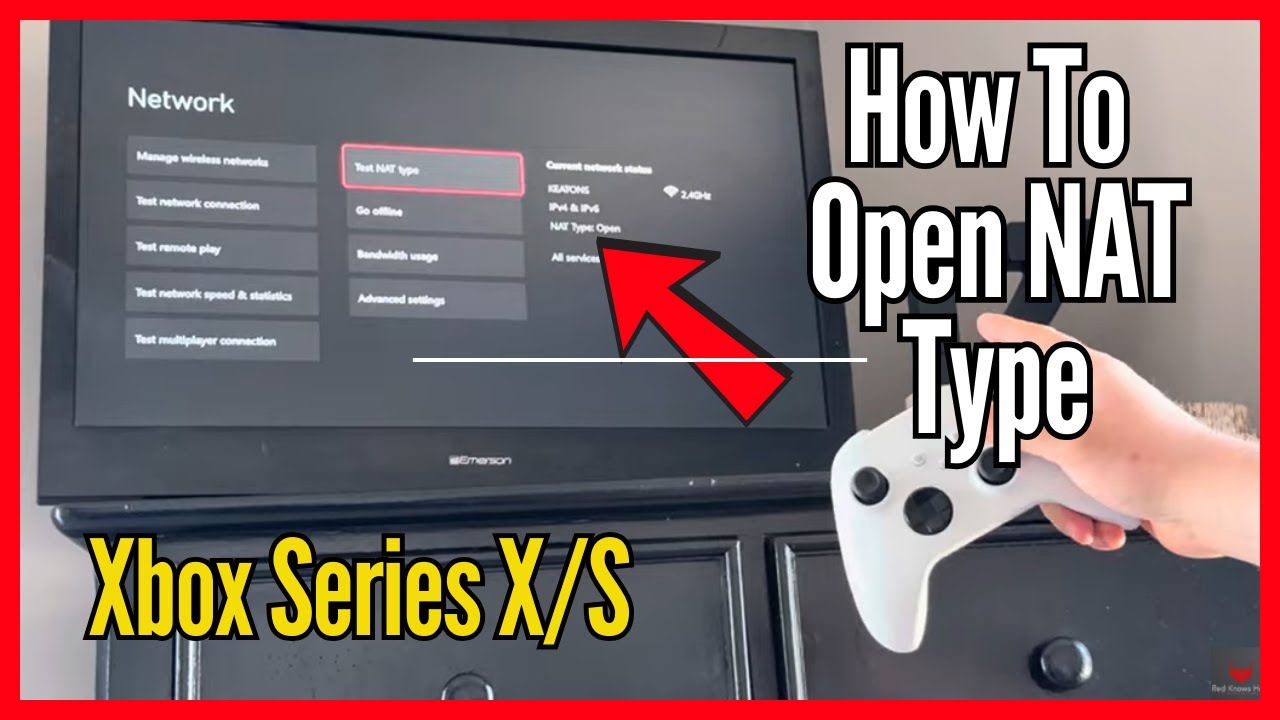 How To Make NAT Type Open on Xbox Series S/X 2025 (Easy Walkthrough!)