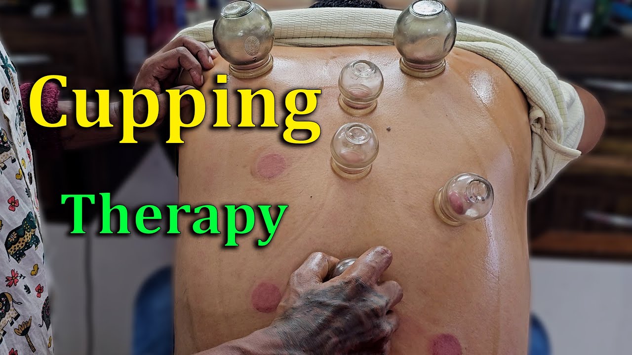Master Cracker&rsquo;s Intense Back Cupping Massage for Pain Relief