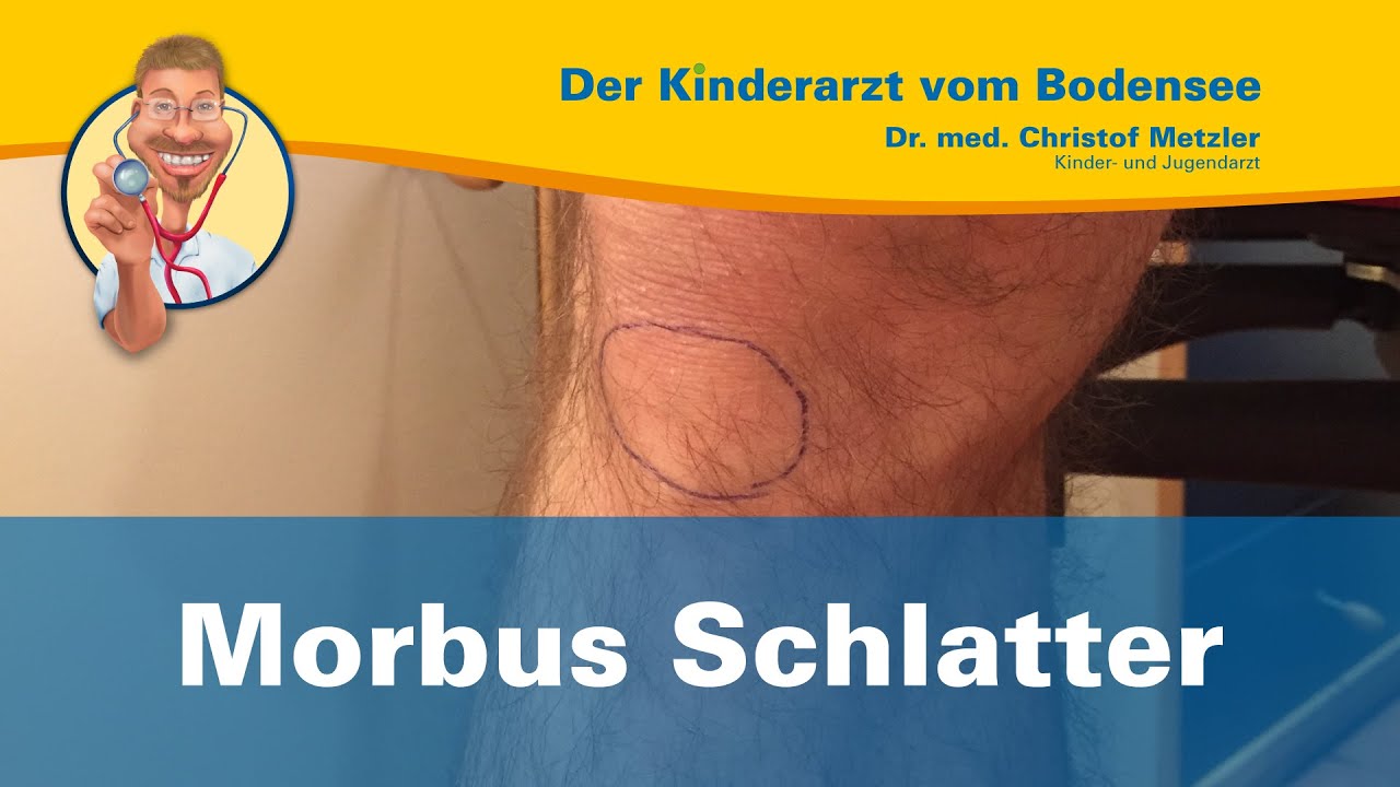 Morbus Schlatter - Der Kinderarzt vom Bodensee