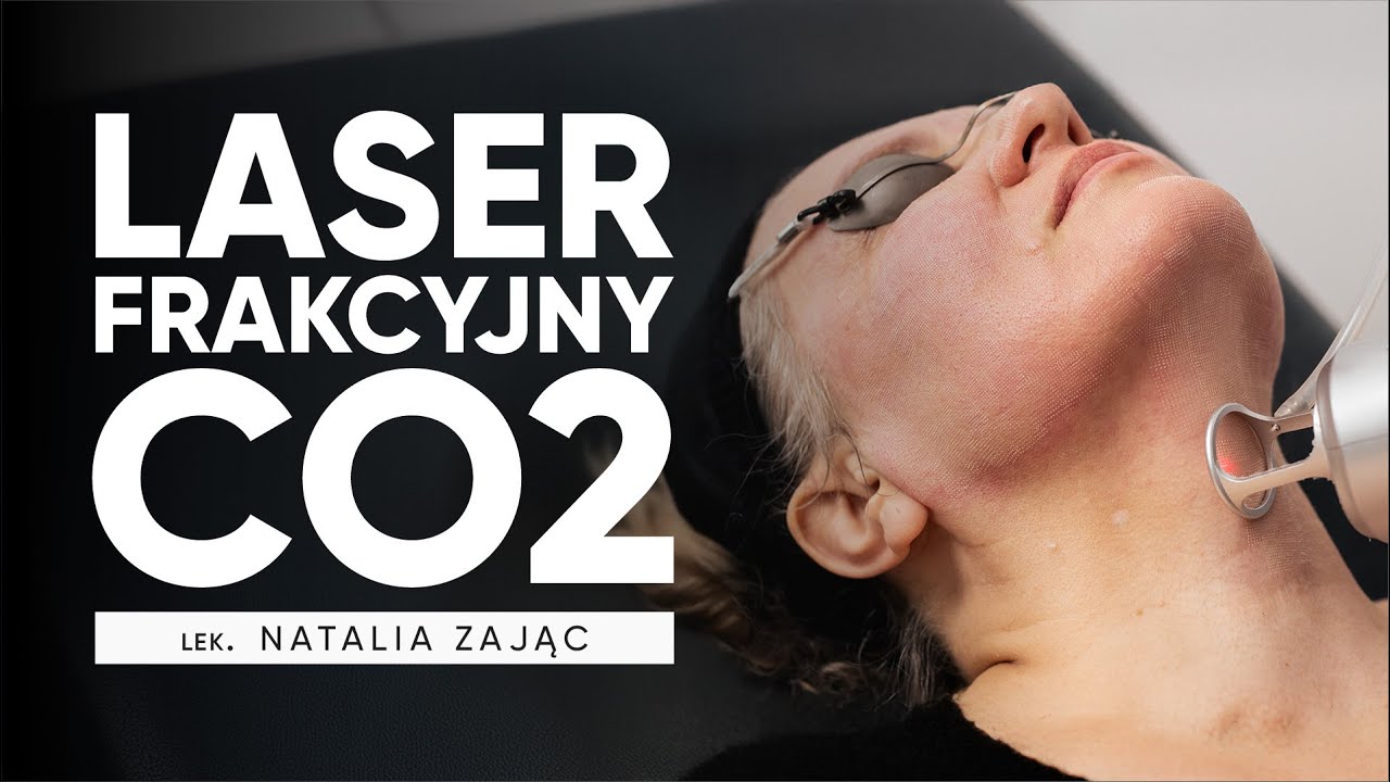 Laser frakcyjny na twarz – jak działa i jakie daje efekty? [Dr Natalia Zając, Ars Estetica]