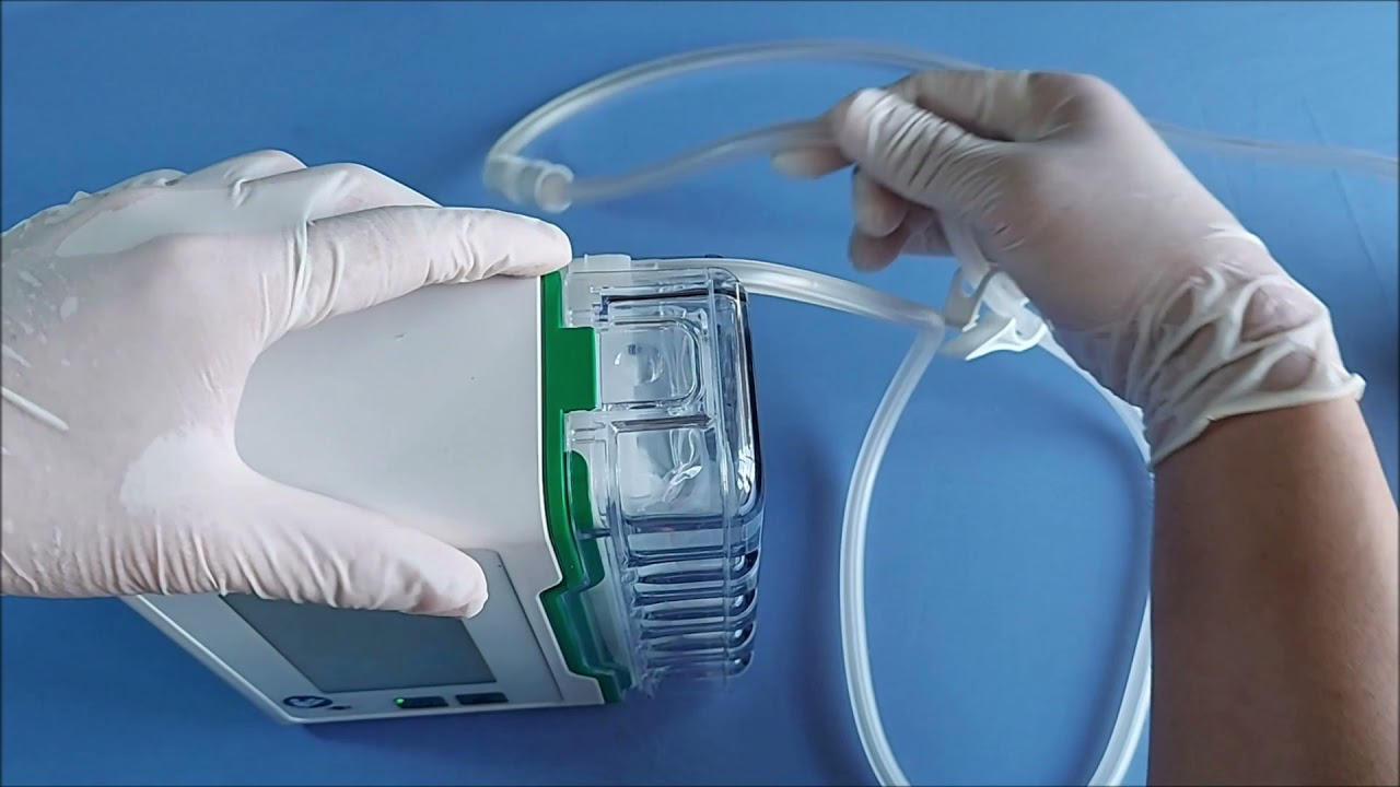 Instruction for removing the container of the CNP P3 while the device is running.