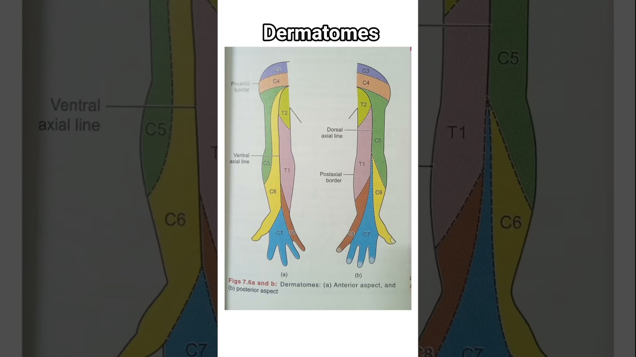 dermatomes