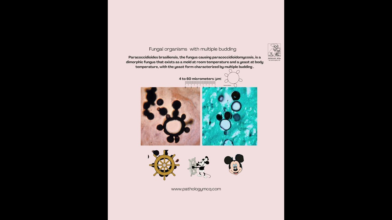 Invasive Fungal Infections &mdash; Histopathology Made Easy | Pathology resident| Pathologist | FRCPath