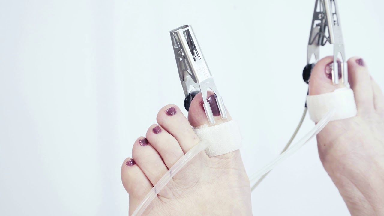 Optical Pulse Oscillography (PPG/OPO/OAP) – Finger & Toe Pressure Measurement (ABI/TBI)