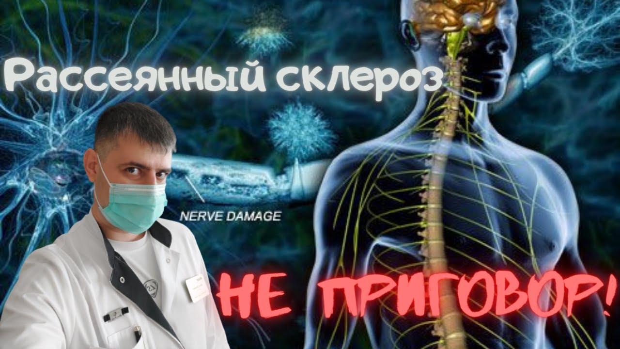Рассеянный склероз, виды, симптомы, лечение