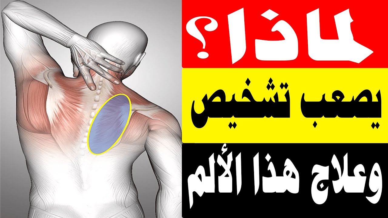 العلاج الفعال للعقد العضلية ونقاط الزناد واللفافة العضلية/أ د محمد حمادة أستاذ علاج الألم بطب الازهر