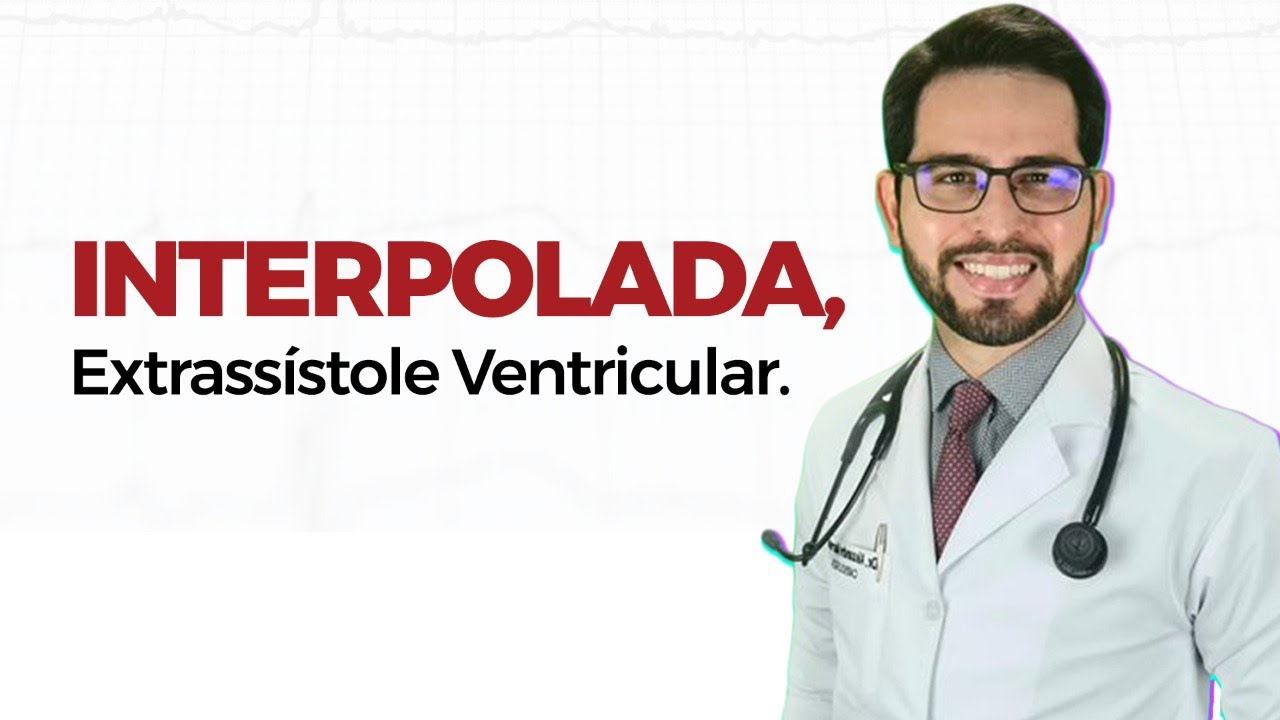 Interpolada, Extrass&iacute;stole Ventricular