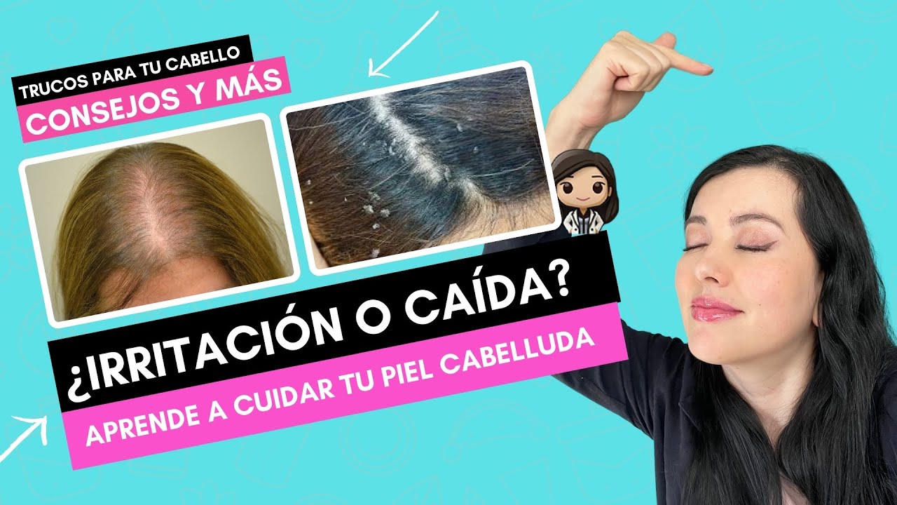 COMO CUIDAR TU PIEL CABELLUDA PARA TENER UN PELO SANO Y LINDO